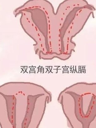 泰国做试管助孕的费用明细，赴泰做试管助孕的流程