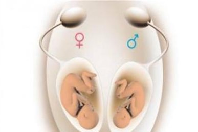 试管婴儿和正常孩子的寿命一样吗(决定试管婴儿寿命的因素有哪些)